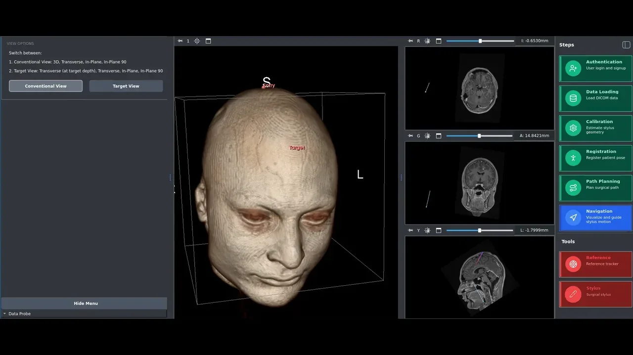Planning view: a volume reconstruction of a head beside axial, coronal and sagittal planes, with entry and target placed on a trajectory.